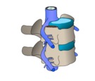 Ejercicios para la hernia discal