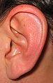 Remedios caseros para el agua en los oídos